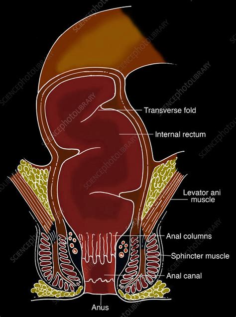 photos of rectum